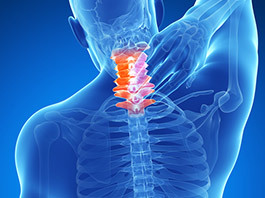 Cervical-Strain-Sprain
