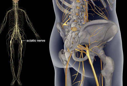 9 Risk Factors for Developing&nbsp;Sciatica