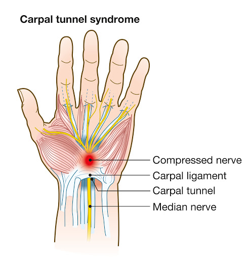 carpal